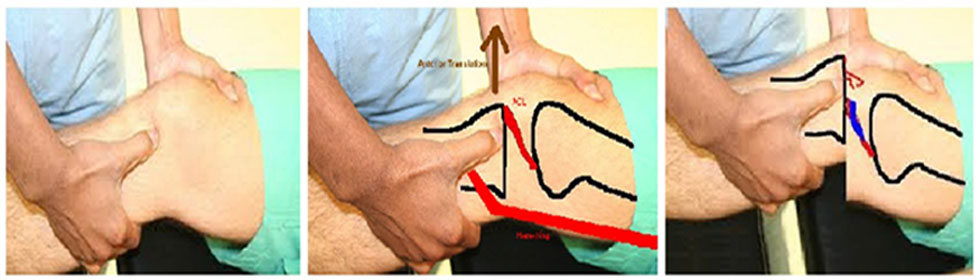 Best-doctor-for-knee-surgery